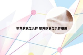 银黄胶囊怎么样 银黄胶囊怎么样服用