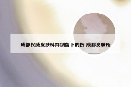 成都权威皮肤科绊倒留下的伤 成都皮肤所