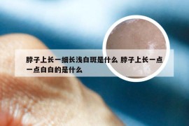 脖子上长一细长浅白斑是什么 脖子上长一点一点白白的是什么