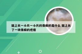 腿上长一小片一小片的像癣的是什么 腿上长了一块像癣的疙瘩