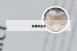 白癜风古方