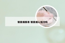 银屑病畏寒 银屑病人怕冷吗