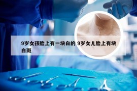 9岁女孩脸上有一块白的 9岁女儿脸上有块白斑
