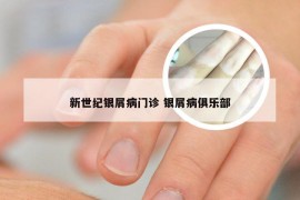 新世纪银屑病门诊 银屑病俱乐部
