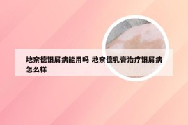 地奈德银屑病能用吗 地奈德乳膏治疗银屑病怎么样