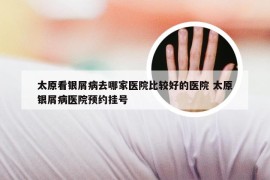 太原看银屑病去哪家医院比较好的医院 太原银屑病医院预约挂号