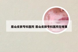眉山皮肤专科医院 眉山皮肤专科医院在哪里