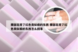腰部出现了红色类似癣的东西 腰部出现了红色类似癣的东西怎么回事