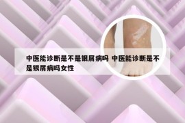 中医能诊断是不是银屑病吗 中医能诊断是不是银屑病吗女性