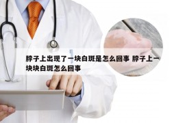 脖子上出现了一块白斑是怎么回事 脖子上一块块白斑怎么回事