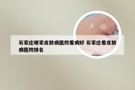 石家庄哪家皮肤病医院看病好 石家庄看皮肤病医院排名
