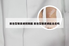 脓包型银屑病初期图 脓包型银屑病能自愈吗