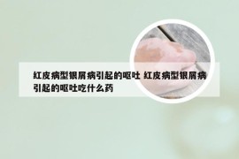 红皮病型银屑病引起的呕吐 红皮病型银屑病引起的呕吐吃什么药