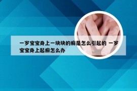 一岁宝宝身上一块块的癣是怎么引起的 一岁宝宝身上起癣怎么办