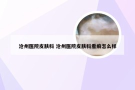 沧州医院皮肤科 沧州医院皮肤科看癣怎么样