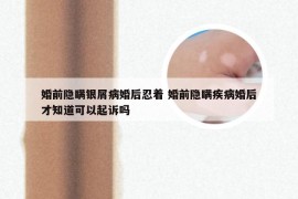 婚前隐瞒银屑病婚后忍着 婚前隐瞒疾病婚后才知道可以起诉吗