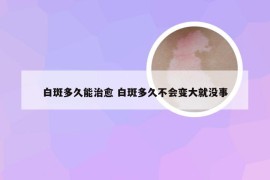 白斑多久能治愈 白斑多久不会变大就没事