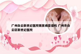 广州白云新世纪医院银屑病靠谱吗 广州市白云区新世纪医院