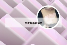 牛皮癣最新消息