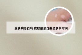 皮肤病忌口吗 皮肤病忌口要忌多长时间