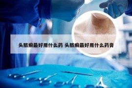 头脓癣最好用什么药 头脓癣最好用什么药膏