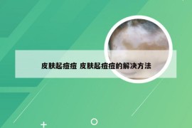 皮肤起痘痘 皮肤起痘痘的解决方法