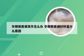 孕期银屑病发作怎么办 孕期银屑病好转是什么原因