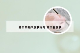 莆田白癜风皮肤治疗 莆田看皮肤