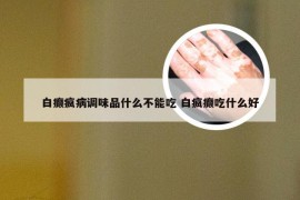 白癫疯病调味品什么不能吃 白疯癫吃什么好