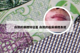 白斑的病理特征是 白斑的临床病理表现
