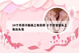 10个月孩子脑袋上有白斑 十个月宝宝头上有白头发