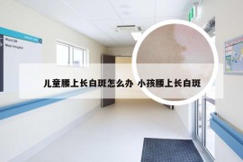 儿童腰上长白斑怎么办 小孩腰上长白斑