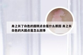 身上长了白色的圆斑点会是什么原因 身上长白色的大圆点是怎么回事