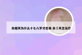 白瘾风为什么十七八岁才出来 白癈风怎治疗