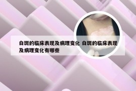 白斑的临床表现及病理变化 白斑的临床表现及病理变化有哪些