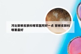 河北邯郸皮肤科哪家医院好一点 邯郸皮肤科哪里最好
