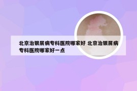 北京治银屑病专科医院哪家好 北京治银屑病专科医院哪家好一点