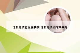 什么膏子能治皮肤病 什么膏子止痒效果好