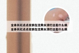全身长红点点皮肤在流黄水溃烂这是什么病 全身长红点点皮肤在流黄水溃烂这是什么病