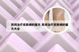 民间治疗皮肤病的偏方 民间治疗皮肤病的偏方大全