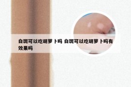 白斑可以吃胡萝卜吗 白斑可以吃胡萝卜吗有效果吗
