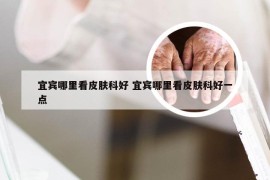 宜宾哪里看皮肤科好 宜宾哪里看皮肤科好一点