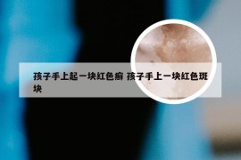 孩子手上起一块红色癣 孩子手上一块红色斑块