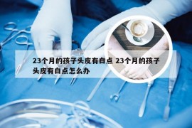 23个月的孩子头皮有白点 23个月的孩子头皮有白点怎么办