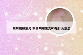 银屑病照紫光 银屑病照紫光03是什么意思