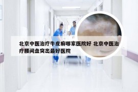 北京中医治疗牛皮癣哪家医院好 北京中医治疗腰间盘突出最好医院