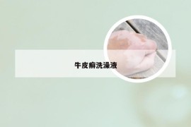 牛皮癣洗澡液