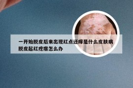 一开始脱皮后来出现红点还痒是什么皮肤病 脱皮起红疙瘩怎么办