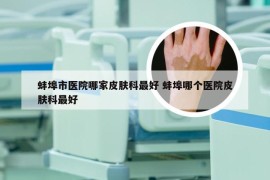 蚌埠市医院哪家皮肤科最好 蚌埠哪个医院皮肤科最好