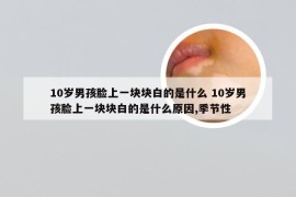 10岁男孩脸上一块块白的是什么 10岁男孩脸上一块块白的是什么原因,季节性